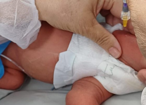 Mato Grosso disponibiliza imunização contra VSR para bebês prematuros