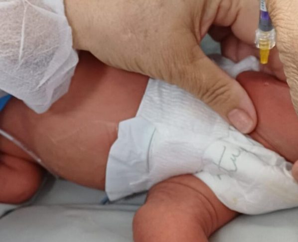 Mato Grosso disponibiliza imunização contra VSR para bebês prematuros