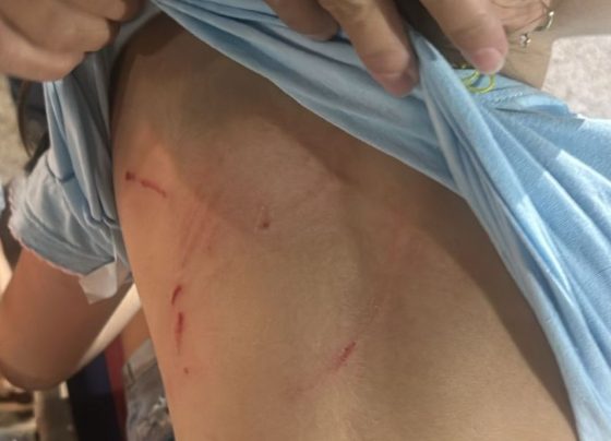 Cachorro ataca criancas em campo novo do parecis foto Reproducao