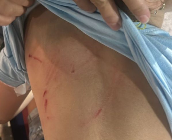 Cachorro ataca criancas em campo novo do parecis foto Reproducao